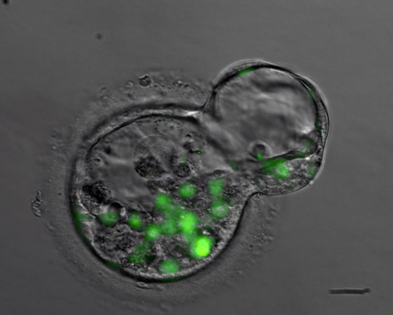 Image: Blastocyst