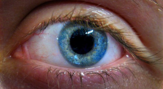 Image: A human eye on June 14, 2007