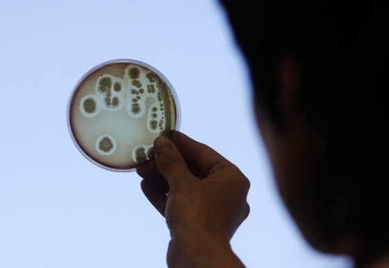 Image: Image: A petri dish with the Escherichia coli (E.coli) bacteria strain