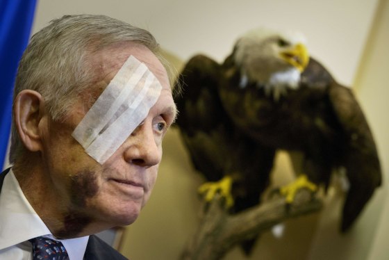 Image: US-POLITICS-REID-INJURY