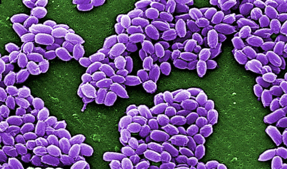 Spores from the Sterne strain of anthrax bacteria (Bacillus anthracis) are pictured in this handout scanning electron micrograph (SEM) obtained by Reuters May 28, 2015. The U.S. military mistakenly sent live anthrax bacteria to laboratories in nine U.S. states and a U.S. air base in South Korea, after apparently failing to properly inactivate the bacteria last year, U.S. officials said on May 27, 2015.
