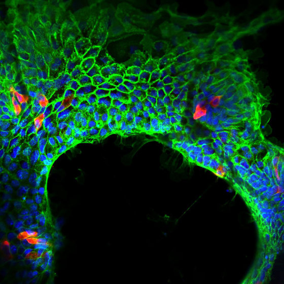 “Lab-made intestine: Johns Hopkins and University of Pittsburgh researches laced material used in surgical sutures with gut stem cells, immune and connective tissue cells. The work brings efforts a step closer to developing a fully implantable intestine as gut replacement therapy.” Photo credit: University of Pittsburgh Medical Center 