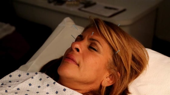 NBC's Hoda Kotb tries acupuncture. 