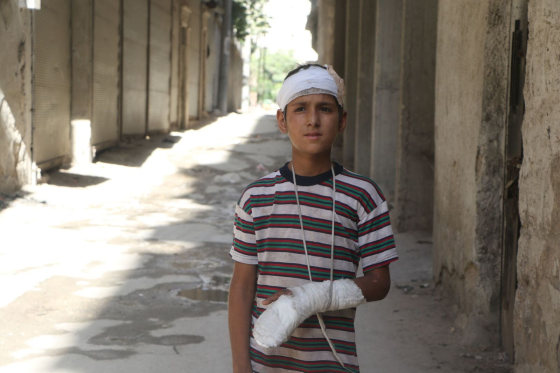 Image: Yahya al-Araj, 11, was injured when an airstrike destroyed his family's apartment in Aleppo.