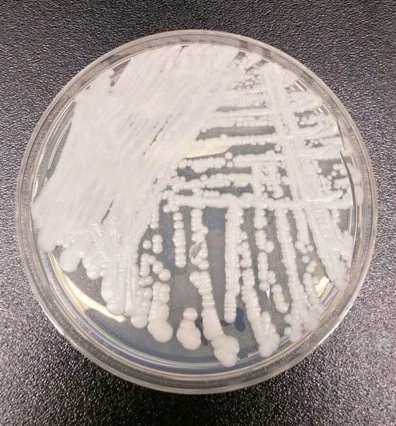 Image: A drug-resistant fungus called Candida auris