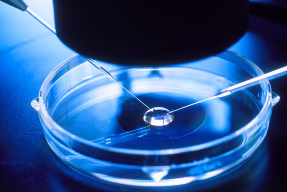 A step in the process of in vitro fertilization.