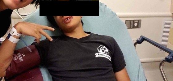 A Vietnamese-American college student was allegedly attacked and told to "go back to Asia" while at a night market. This photo was provided by the student, who wishes to remain anonymous.