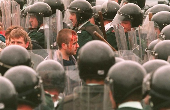 Image: A protester is wounded after police advanced on a sit down protest by Catholics to stop Orange protestant marchers in Drumcree
