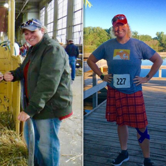 Karla Pankow before and after her 100 pound weight loss.