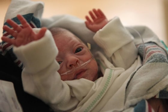 A preterm baby in a NICU. Preterm babies are far more likely to die, and the US has one of the highest infant mortality rates in the developed world.