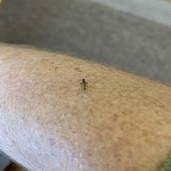 Bug Bite Thing: I tried this gadget to treat bug bites - TODAY