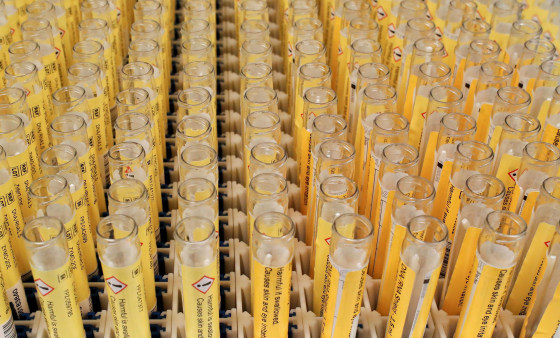 Image: PCR test for the coronavirus disease (COVID-19) in a laboratory at the University of Liege, Belgium