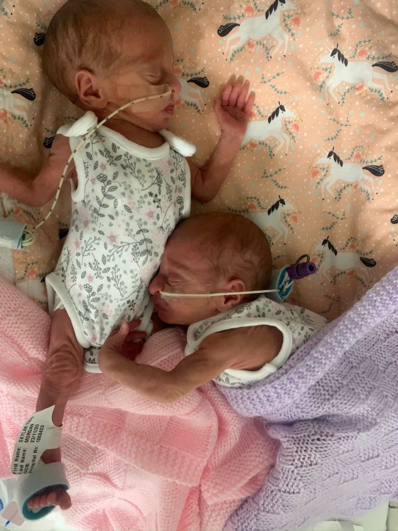 The Adorable Moment Premature Twins Cuddle Each Other Just After Being Born 2
