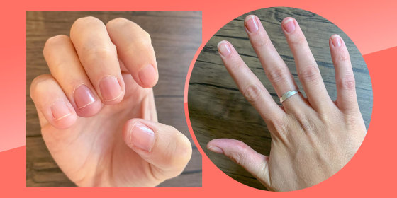 Before and after illustration of Emma Stessmans hand after using the ella+mila Nail Care