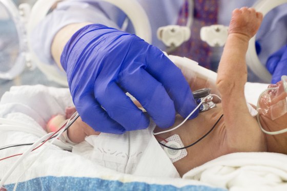 A doctor checks on an infant
