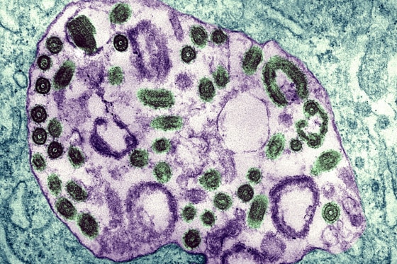 Marburg Virus