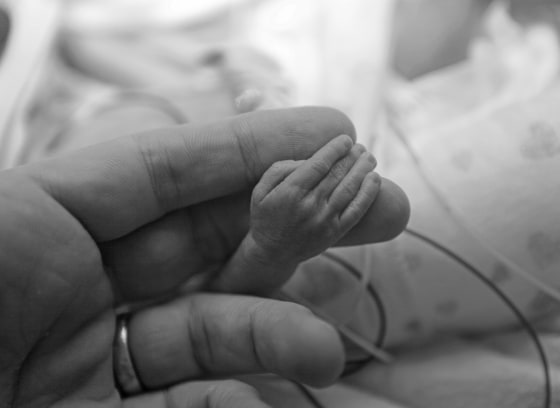 A preterm baby in a NICU.