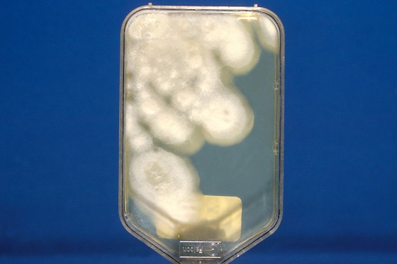 Close-up photograph of the Sebouraud dextrose agar culture of the pathogenic fungus Coccidioides immitis with chloramphenicol and cycloheximide after 2 weeks, 1979.