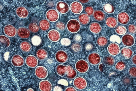 Image: This colorized electron microscope image shows mpox particles, red, found within an infected cell, blue, cultured in a laboratory in Fort Detrick, Md.