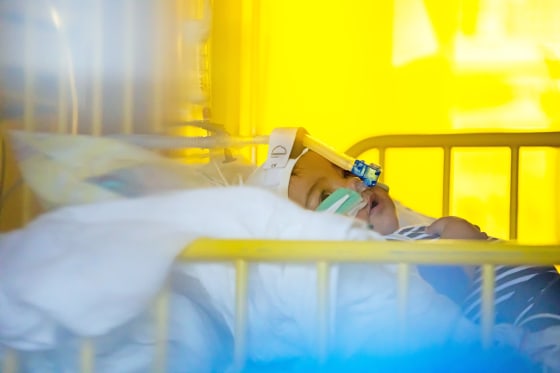 A baby is treated in the intensive care unit of the pediatric clinic at St. Joseph Hospital in Berlin