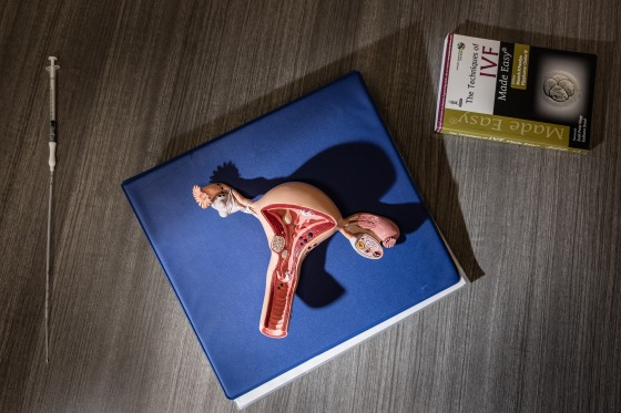 A model of the female reproductive system and an embryo transfer catheter, along with the book titled, "The Techniques of IVF Made Easy."