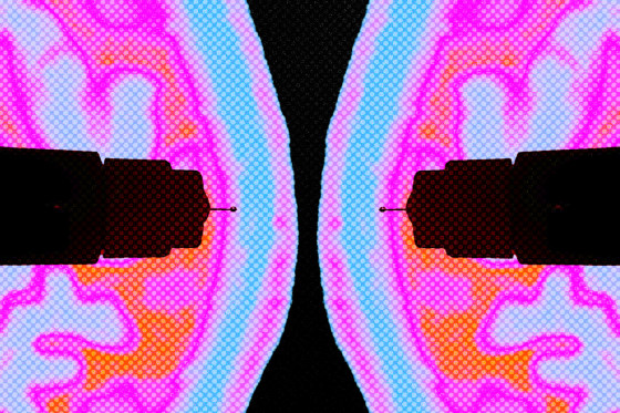 Symmetrical brain scans cutout in the shape of Ozempic needles.