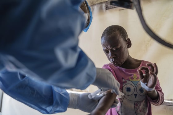 Mpox patient 