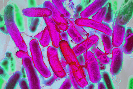 Escherichia coli.