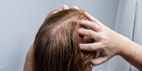 Experts recommend washing with sulfate-free shampoos, avoiding heat styling and continuing to take prenatal vitamins.
