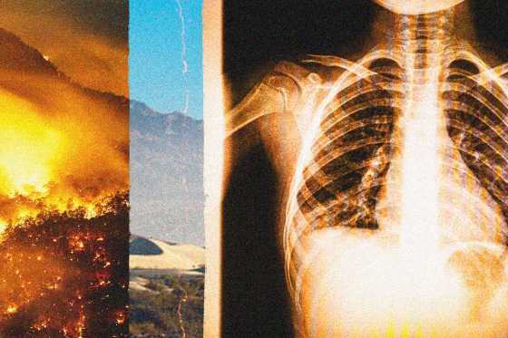 Photo collage with a photo of a burning California valley imposed over a photo of a valley in daytime. On the right side, an x-ray scan of a chest and lungs with orange overlay.