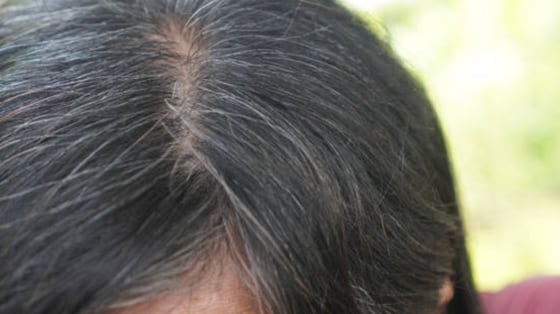 Cabello humano