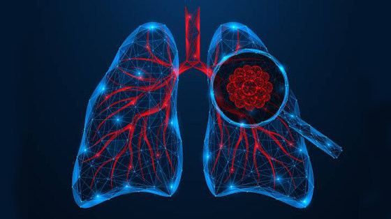 Pulmones