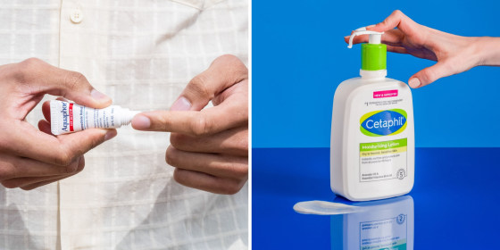 Accutane users should consider moisture-rich skin care products.