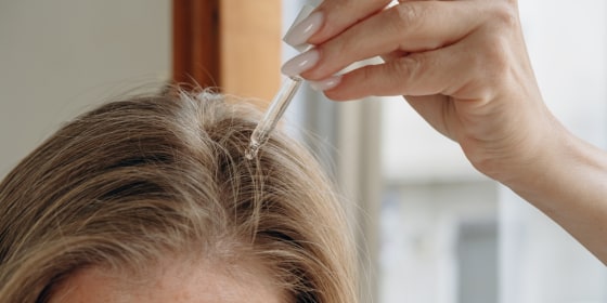 Minoxidil is the most proven treatment for thinning hair in both men and women, experts say.