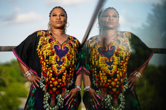 Charleetra Hornes alleges she received injuries that left her disfigured during cosmetic surgery at Goals Plastic Surgery in Atlanta.