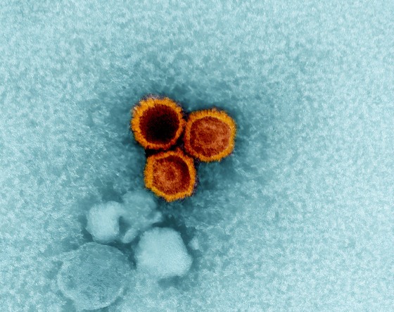 Epstein-barr virus particles