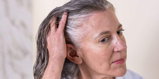 Derms recommend how to treat both concerns with highly-rated treatments.