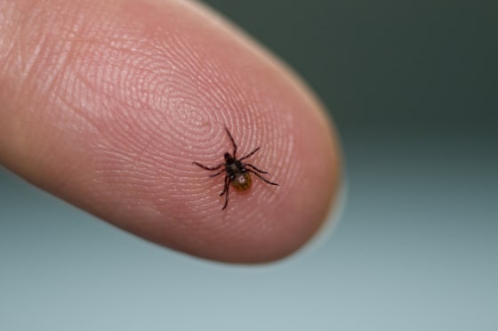 Image: Deer tick, Ixodes scapularis, on a fingertip