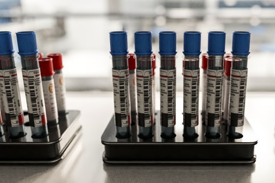Blood samples in test tubes for medical diagnostics