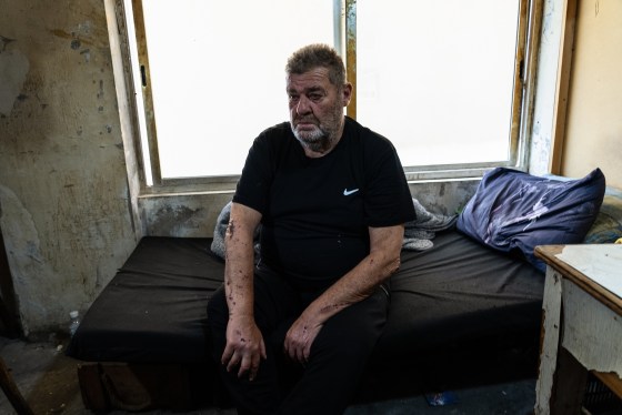 A man with wounds visible on his arms sits on a cot with an exhausted expression.