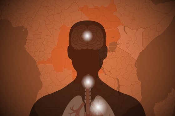 The speed and scale of the outbreak in Congo is causing worry about potential spread to other areas or countries.