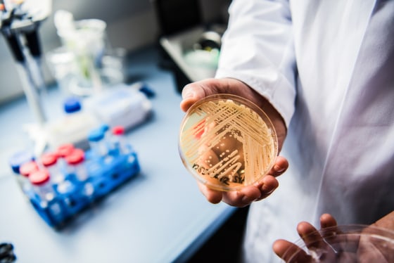 A hand holding a petri dish with yeast inside, thick beige lines are scattered on top of a clear dish
