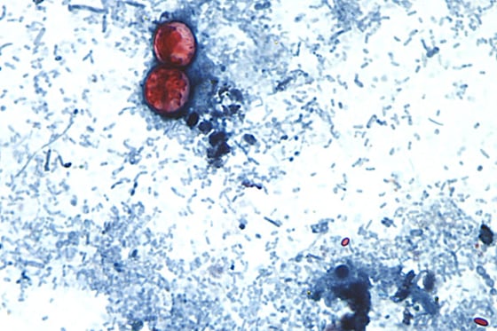 This photomicrograph shows Cyclospora oocysts
