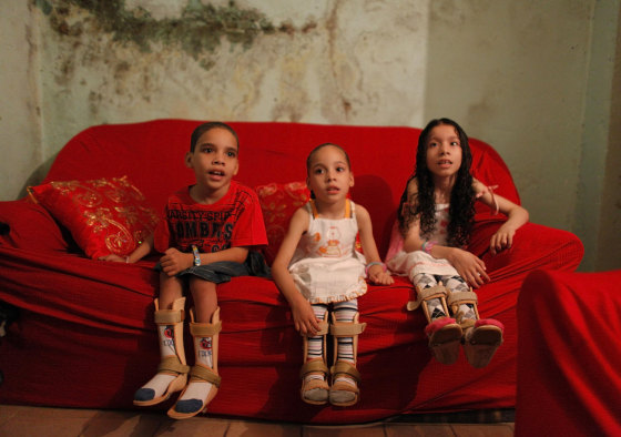 The children of the Amor Divino family, (L-R) Dhones, Izabely and Samille, sit on their couch after their parents dressed them for a weekly physical therapy session, in the Brasilandia favela of Sao Paulo, before sunrise on March 23. All three children suffer from a disease called Pelizaeus-Merzbacher, a rare genetic nervous disorder which affects coordination and intellect. Brazil's social security system INSS granted the family monetary assistance only for one of the three children, leaving the others to depend on the income from their father's job in a bakery.