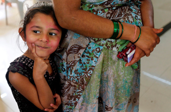 5-year-old Ritika Borde, a victim of poisoning from colored powder and water used during Holi celebrations, stands in a queue to be treated at a government hospital in Mumbai, India, Friday, March 9, 2012. More than 140 children from Dharavi area of Mumbai were hospitalized following use of toxic colors, according to a news agency. (AP Photo/Rajanish Kakade)