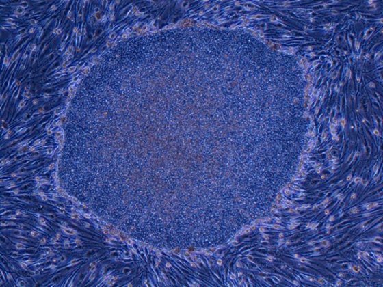 This undated handout photo shows iPS cells derived from adult human dermal fibroblasts released by Kyoto University Professor Shinya Yamanaka at Center for iPS Cell Research and Application of Kyoto University in Kyoto, western Japan.