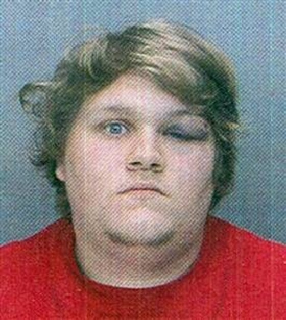 Matthew Clemmens is facing charges after Philadelphia police say he intentionally vomited on a police captain. Authorities say he was hit as he was being subdued.