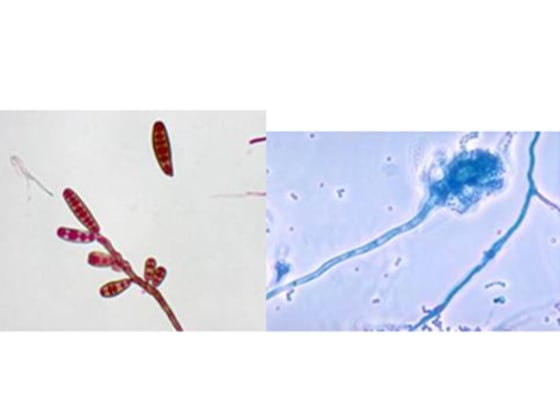 Two types of fungi have been detected in the ongoing outbreak of meningitis related to contaminated steroid injections. Exserohilum, left, and Aspergillus, right, have been detected in patients.