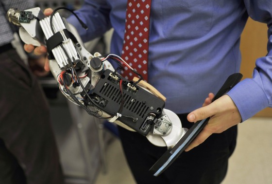 Dr. Levi Hargrove, lead researcher for the Rehabilitation Institute of Chicago's Center for Bionic Medicine, holds an experimental 'bionic' prosthetic leg.