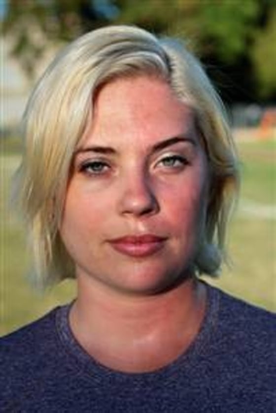 Rebecca Adler, a freelance writer in Sacramento, has lived with Harlequin Syndrome for 29 years.